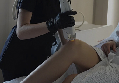 Лазерная эпиляция